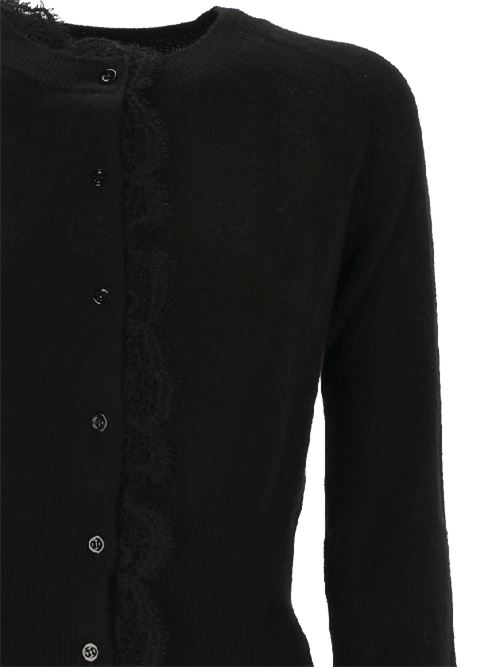 Cardigan nero con pizzo Ermanno Scervino | D455N313APPYU95708